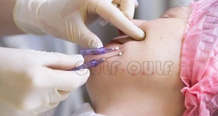 線(xiàn)雕最新手法，背景、發(fā)展、時(shí)代地位及展望